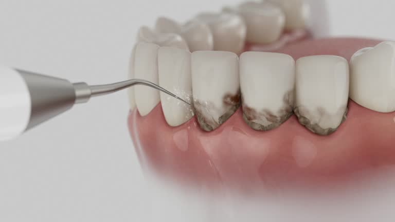 Reliable Dental Implants contractor in Collierville, TN by Smile Center Dentistry